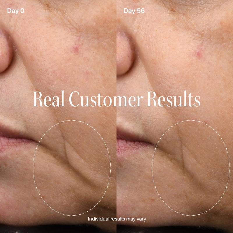 LumiReset Pro 4-in-1 Red Light Therapy Mask