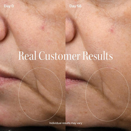 LumiReset Pro 4-in-1 Red Light Therapy Mask